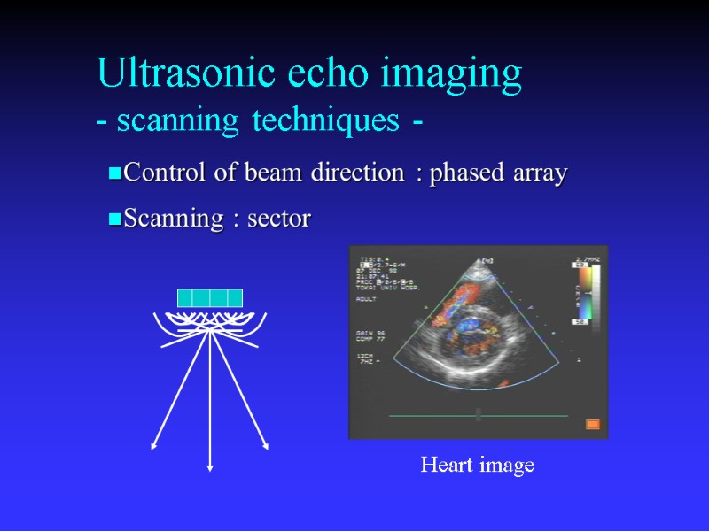 Ultrasonic echo imaging - scanning techniques - Control of beam direction : phased array
